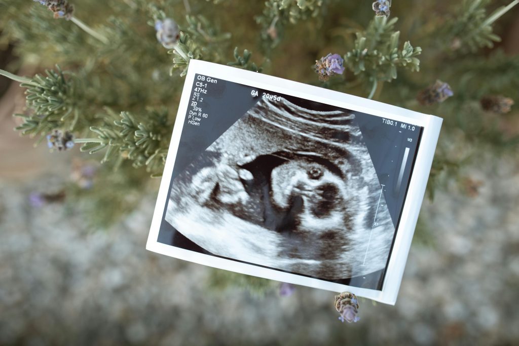 ultraschallbild mit lavendel im hintergrund